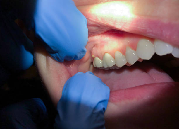 Best Mobile Emergency Dentist in Warrior, AL